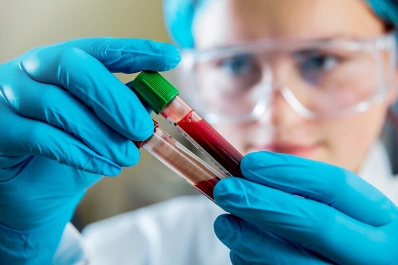 Complete blood test to diagnose low back pain